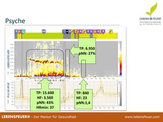 25.02.2015 10325.02.2015 103LEBENSFEUER® - Der Marker für Gesundheit www.lebensfeuer.com
TP: 15.600
HF: 3.560
pNN: 43%
HRmin: 37
TP: 6.950
pNN: 27%
Psyche
TP: 840
HF: 23
pNN:1,4
 