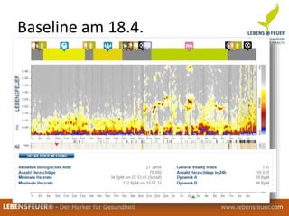 25.02.2015 11725.02.2015 117LEBENSFEUER® - Der Marker für Gesundheit www.lebensfeuer.com25.02.2015 117LEBENSFEUER® - Der Marker für Gesundheit www.lebensfeuer.com
Baseline am 18.4.
 