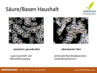 25.02.2015 9225.02.2015 92LEBENSFEUER® - Der Marker für Gesundheit www.lebensfeuer.com25.02.2015 92LEBENSFEUER® - Der Marker für Gesundheit www.lebensfeuer.com
Säure/Basen Haushalt
„basisches“, gesundes Blut
verklumpte Rote Blutkörperchen,
„Geldrollenphänomen“
= gute Sauerstoff- und
Nährstoffversorgung
„übersäuertes“ Blut
 