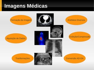Imagens Médicas

   Formação da Imagem    Artefatos Diversos




                          Exibição/Compressão
Aquisição de Dados




        Tranformações   Conversão AD-DA
 