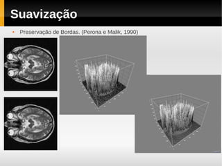 Suavização
   Preservação de Bordas. (Perona e Malik, 1990)
 