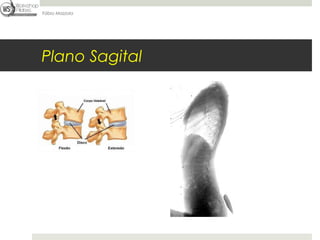 Fábio Mazzola




Plano Sagital
 