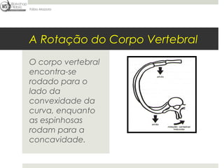 Fábio Mazzola




A Rotação do Corpo Vertebral
O corpo vertebral
encontra-se
rodado para o
lado da
convexidade da
curva, enquanto
as espinhosas
rodam para a
concavidade.
 
