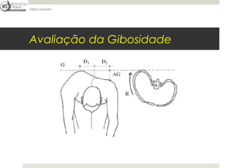 Fábio Mazzola




Avaliação da Gibosidade
 