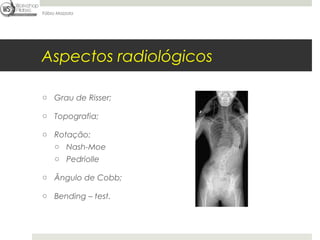 Fábio Mazzola




Aspectos radiológicos

o Grau de Risser;

o Topografia;

o Rotação:
  o Nash-Moe
     o Pedriolle

o Ângulo de Cobb;

o Bending – test.
 