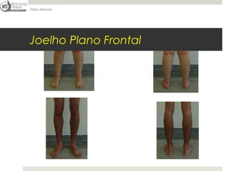 Fábio Mazzola




Joelho Plano Frontal
 