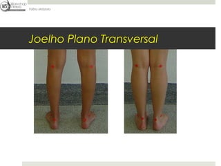 Fábio Mazzola




Joelho Plano Transversal
 