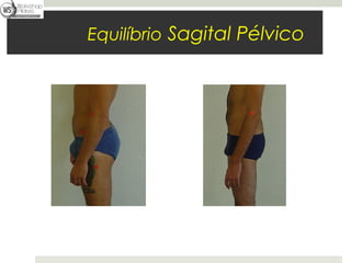 Fábio Mazzola



                Equilíbrio Sagital Pélvico
 