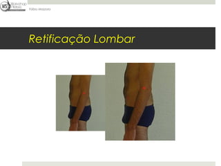 Fábio Mazzola




Retificação Lombar
 