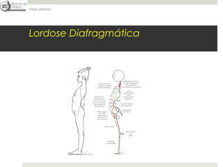 Fábio Mazzola




Lordose Diafragmática
 