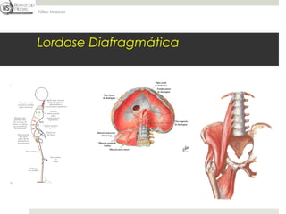 Fábio Mazzola




Lordose Diafragmática
 