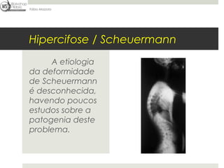 Fábio Mazzola




Hipercifose / Scheuermann
     A etiologia
da deformidade
de Scheuermann
é desconhecida,
havendo poucos
estudos sobre a
patogenia deste
problema.
 
