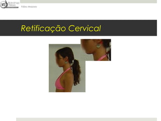 Fábio Mazzola




Retificação Cervical
 