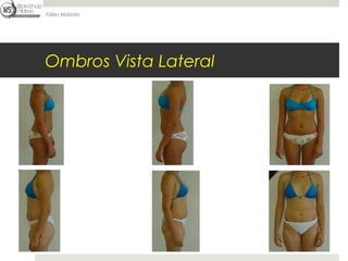 Fábio Mazzola




Ombros Vista Lateral
 