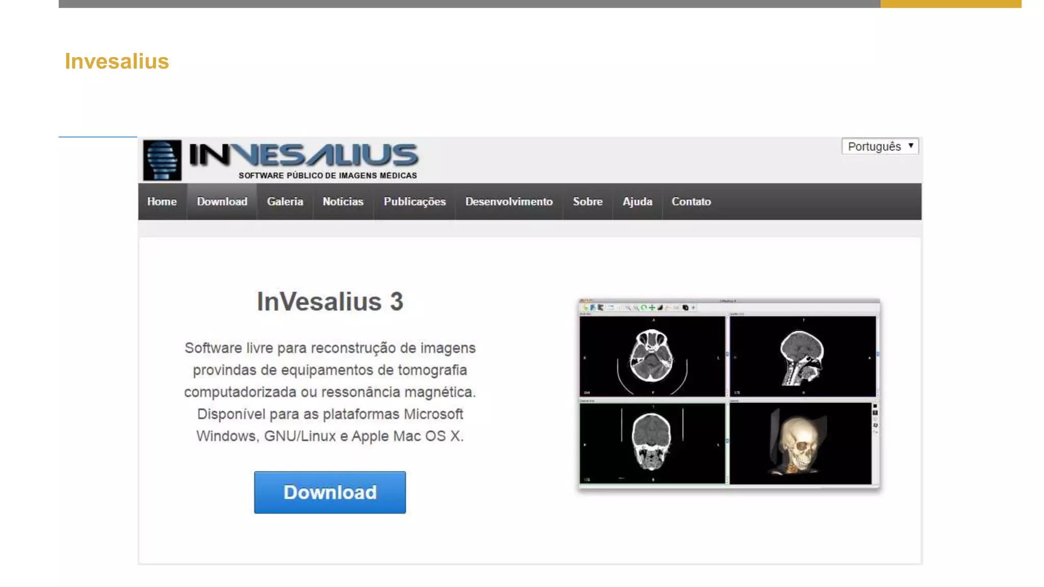 Invesalius
 