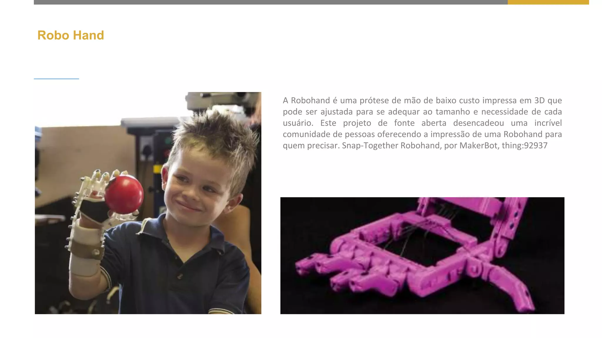 Robo Hand
A Robohand é uma prótese de mão de baixo custo impressa em 3D que
pode ser ajustada para se adequar ao tamanho e necessidade de cada
usuário. Este projeto de fonte aberta desencadeou uma incrível
comunidade de pessoas oferecendo a impressão de uma Robohand para
quem precisar. Snap-Together Robohand, por MakerBot, thing:92937
 