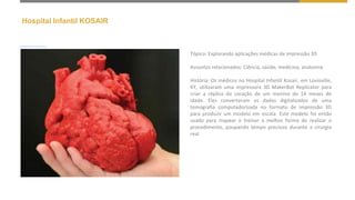 Hospital Infantil KOSAIR
Tópico: Explorando aplicações médicas de impressão 3D
Assuntos relacionados: Ciência, saúde, medicina, anatomia
História: Os médicos no Hospital Infantil Kosair, em Louisville,
KY, utilizaram uma impressora 3D MakerBot Replicator para
criar a réplica do coração de um menino de 14 meses de
idade. Eles converteram os dados digitalizados de uma
tomografia computadorizada no formato de impressão 3D
para produzir um modelo em escala. Este modelo foi então
usado para mapear e treinar a melhor forma de realizar o
procedimento, poupando tempo precioso durante a cirurgia
real.
 