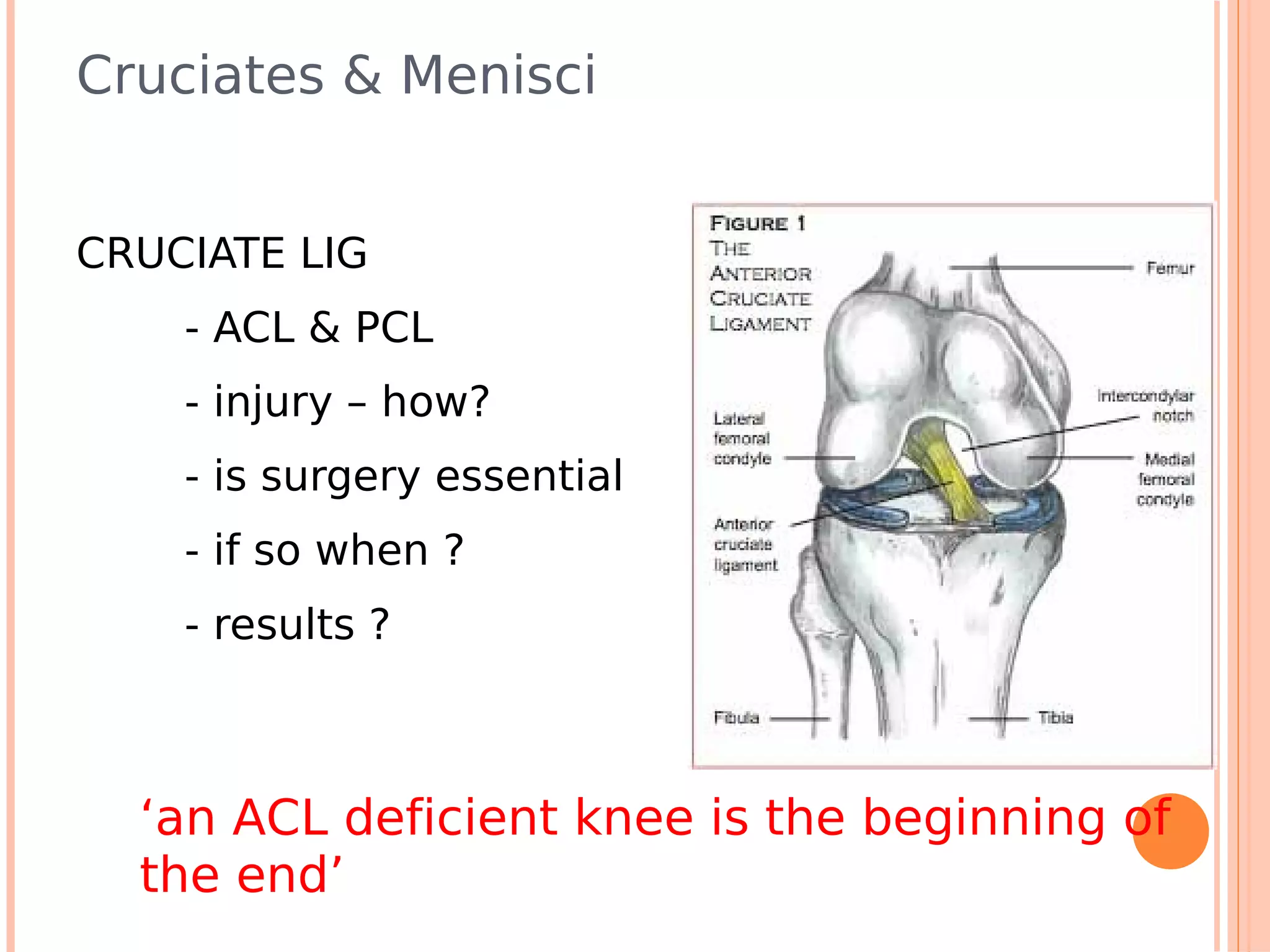 Cruciates & Menisci


CRUCIATE LIG
    - ACL & PCL
    - injury – how?
    - is surgery essential
    - if so when ?
    - results ?



  ‘an ACL deficient knee is the beginning of
  the end’
 
