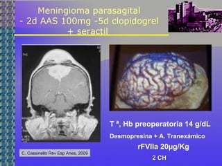 Meningioma parasagital
- 2d AAS 100mg -5d clopidogrel
+ seractil
T ª, Hb preoperatoria 14 g/dL
Desmopresina + A. Tranexámico
rFVIIa 20µg/Kg
2 CH2 CH
C. Cassinello Rev Esp Anes, 2009
 