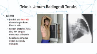 Comprehensive Radiology Workshop on Thorax and Abdomen Imaging | PPTX
