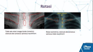 Comprehensive Radiology Workshop on Thorax and Abdomen Imaging | PPTX