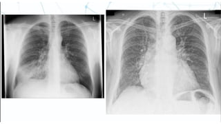 Comprehensive Radiology Workshop on Thorax and Abdomen Imaging | PPTX