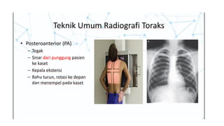 Comprehensive Radiology Workshop on Thorax and Abdomen Imaging | PPTX