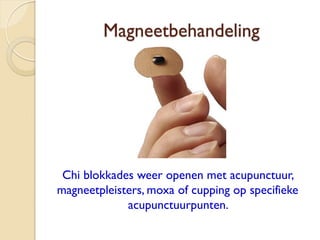 Magneetbehandeling
Chi blokkades weer openen met acupunctuur,
magneetpleisters, moxa of cupping op specifieke
acupunctuurpunten.
 
