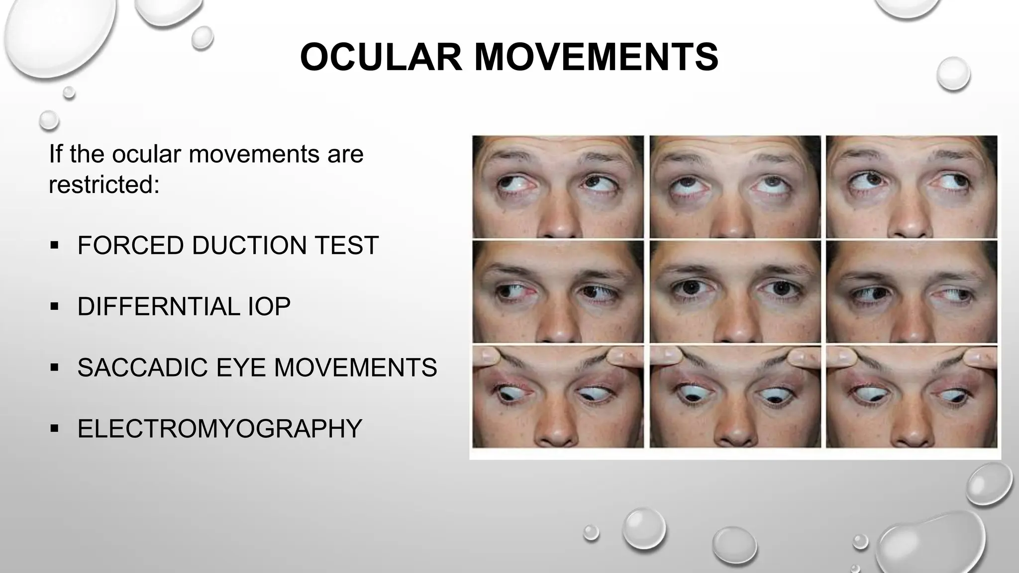 OCULAR MOVEMENTS
If the ocular movements are
restricted:
 FORCED DUCTION TEST
 DIFFERNTIAL IOP
 SACCADIC EYE MOVEMENTS
 ELECTROMYOGRAPHY
 