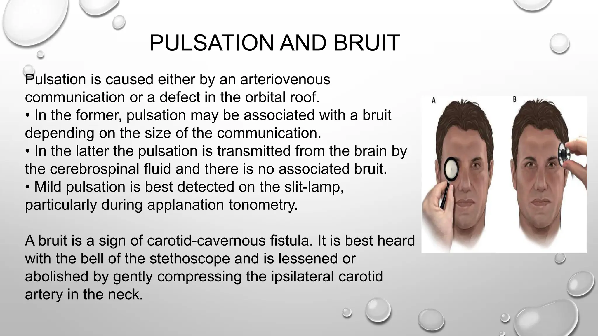 PULSATION AND BRUIT
Pulsation is caused either by an arteriovenous
communication or a defect in the orbital roof.
• In the former, pulsation may be associated with a bruit
depending on the size of the communication.
• In the latter the pulsation is transmitted from the brain by
the cerebrospinal fluid and there is no associated bruit.
• Mild pulsation is best detected on the slit-lamp,
particularly during applanation tonometry.
A bruit is a sign of carotid-cavernous fistula. It is best heard
with the bell of the stethoscope and is lessened or
abolished by gently compressing the ipsilateral carotid
artery in the neck.
 