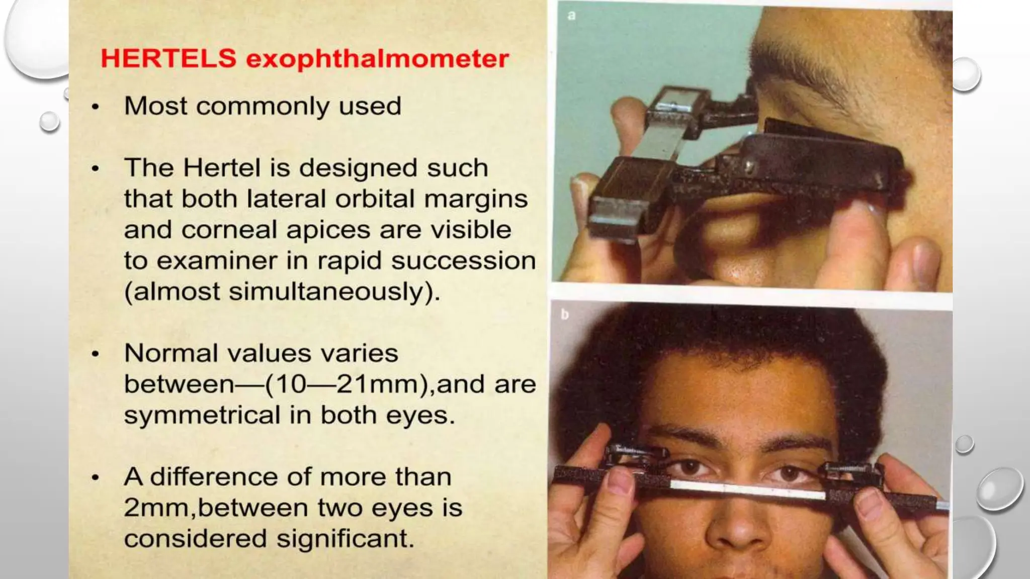 HERTEL EXOPHTALMOMETER
 