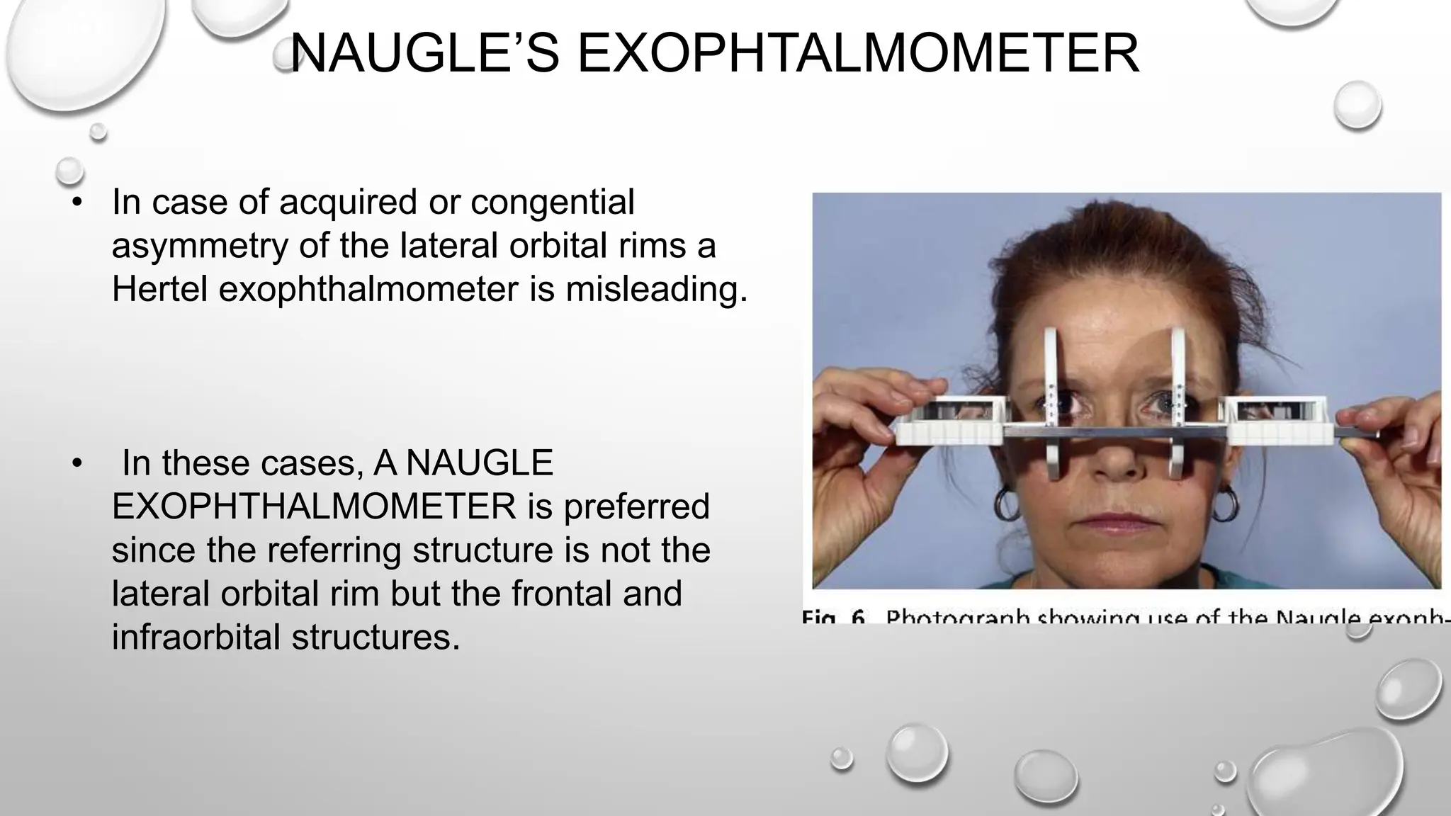 NAUGLE’S EXOPHTALMOMETER
• In case of acquired or congential
asymmetry of the lateral orbital rims a
Hertel exophthalmometer is misleading.
• In these cases, A NAUGLE
EXOPHTHALMOMETER is preferred
since the referring structure is not the
lateral orbital rim but the frontal and
infraorbital structures.
 