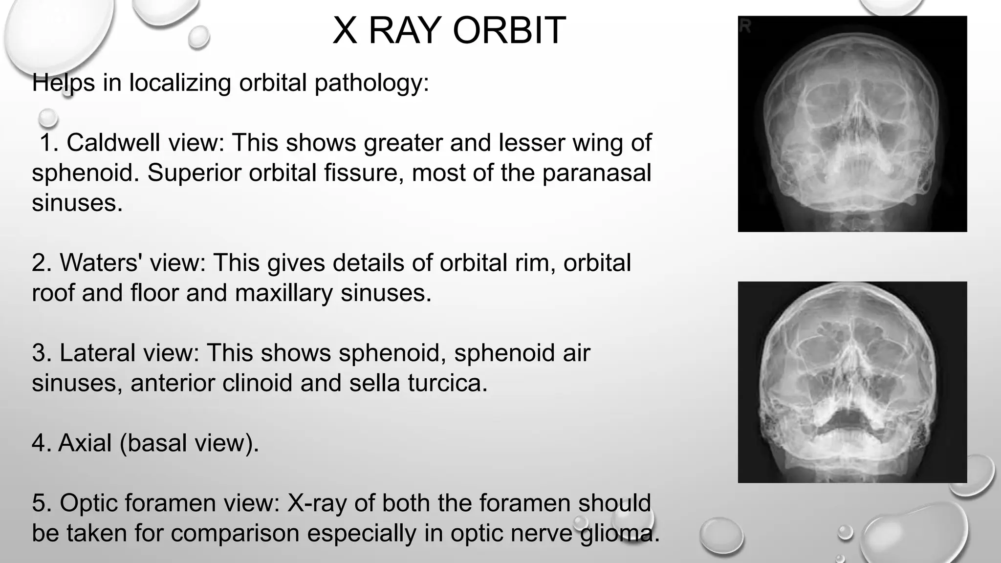 X RAY ORBIT
Helps in localizing orbital pathology:
1. Caldwell view: This shows greater and lesser wing of
sphenoid. Superior orbital fissure, most of the paranasal
sinuses.
2. Waters' view: This gives details of orbital rim, orbital
roof and floor and maxillary sinuses.
3. Lateral view: This shows sphenoid, sphenoid air
sinuses, anterior clinoid and sella turcica.
4. Axial (basal view).
5. Optic foramen view: X-ray of both the foramen should
be taken for comparison especially in optic nerve glioma.
 