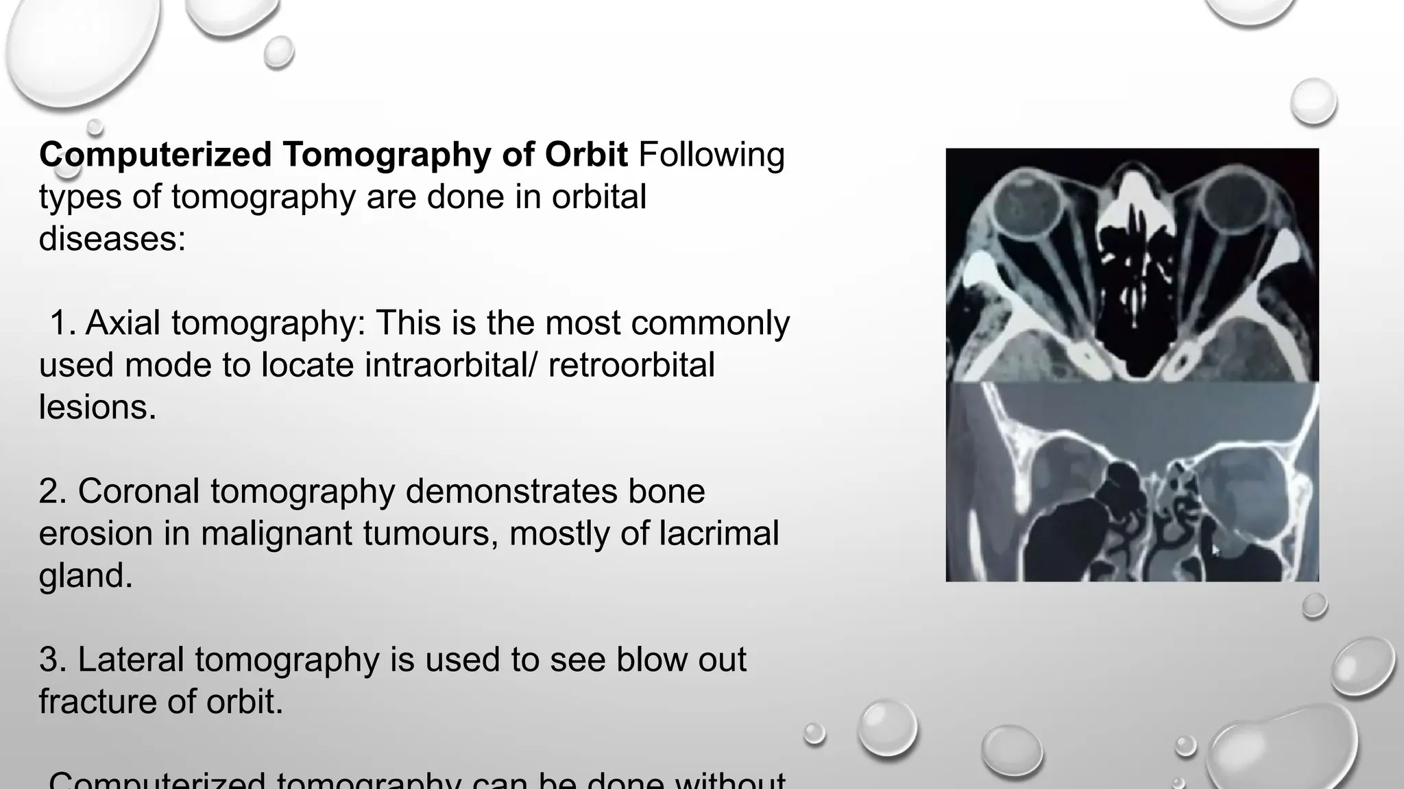 Computerized Tomography of Orbit Following
types of tomography are done in orbital
diseases:
1. Axial tomography: This is the most commonly
used mode to locate intraorbital/ retroorbital
lesions.
2. Coronal tomography demonstrates bone
erosion in malignant tumours, mostly of lacrimal
gland.
3. Lateral tomography is used to see blow out
fracture of orbit.
 
