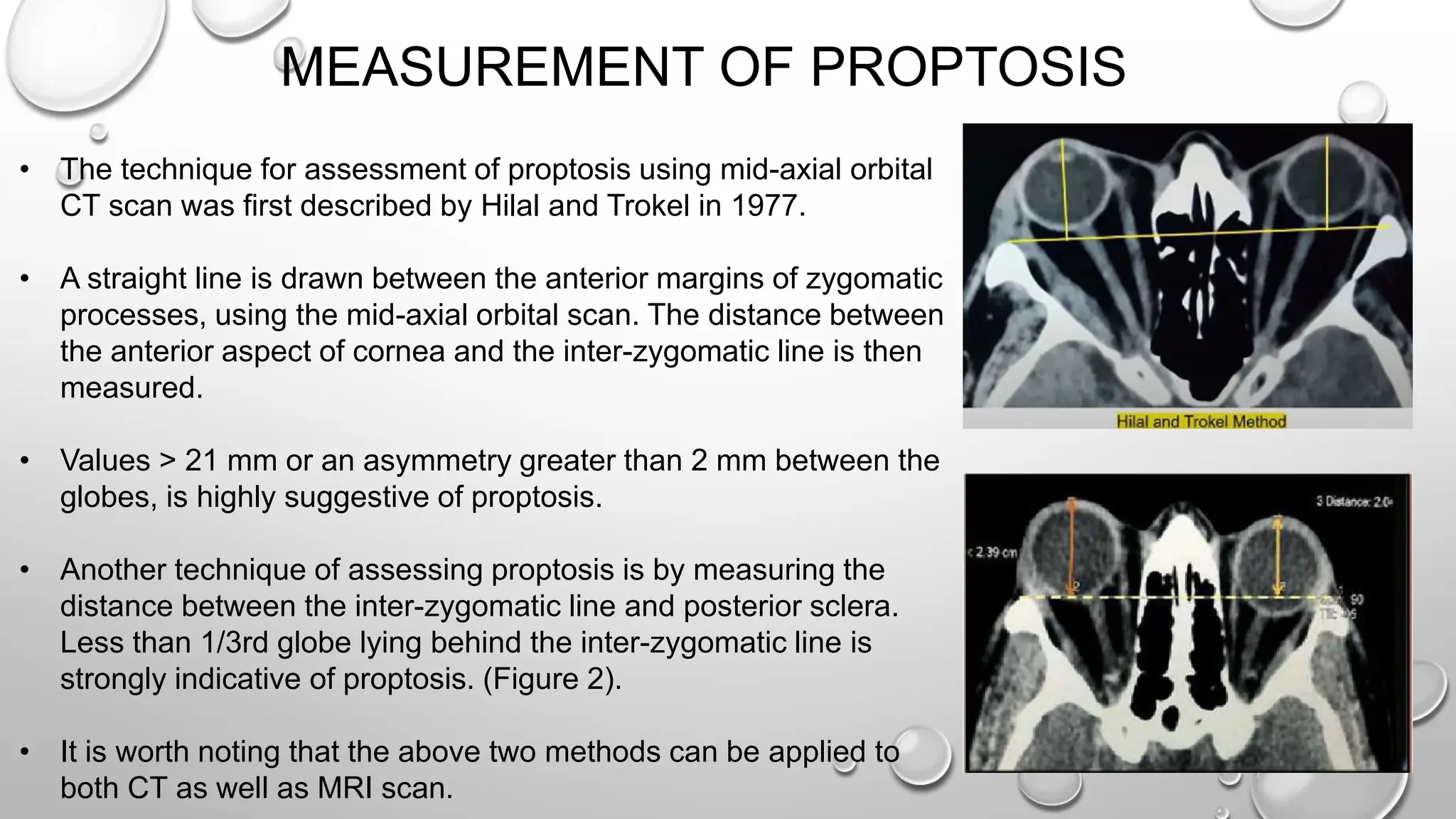 MEASUREMENT OF PROPTOSIS
• The technique for assessment of proptosis using mid-axial orbital
CT scan was first described by Hilal and Trokel in 1977.
• A straight line is drawn between the anterior margins of zygomatic
processes, using the mid-axial orbital scan. The distance between
the anterior aspect of cornea and the inter-zygomatic line is then
measured.
• Values > 21 mm or an asymmetry greater than 2 mm between the
globes, is highly suggestive of proptosis.
• Another technique of assessing proptosis is by measuring the
distance between the inter-zygomatic line and posterior sclera.
Less than 1/3rd globe lying behind the inter-zygomatic line is
strongly indicative of proptosis. (Figure 2).
• It is worth noting that the above two methods can be applied to
both CT as well as MRI scan.
 
