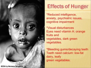 *Reduced intelligence, anxiety, psychiatric issues, cognitive impairment *Visual disturbances Eyes need vitamin A: orange fruits and vegetables, dark green vegetables. *Bleeding gums/decaying teeth Teeth need calcium: low-fat dairy, leafy green vegetables. 