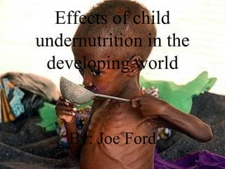 Effects of child undernutrition in the developing world By: Joe Ford 