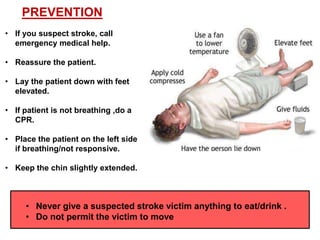 PREVENTION
• If you suspect stroke, call
emergency medical help.

• Reassure the patient.
• Lay the patient down with feet
elevated.
• If patient is not breathing ,do a
CPR.
• Place the patient on the left side
if breathing/not responsive.
• Keep the chin slightly extended.

• Never give a suspected stroke victim anything to eat/drink .
• Do not permit the victim to move

 