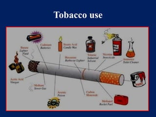 Tobacco use 
 