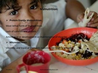 Malnutrition:
 Protein Energy Malnutrition:
Most lethal form of malnutrition
Lack of calories and protein
Amino acid or development or maintenance of muscles
 Micronutrients:
Vitamins and trace of elements essential for healthy growth
7/1/2013 mianusman67@yahoo.com 4
 