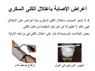 ‫السكري‬ ‫الكلى‬ ‫باعتالل‬ ‫اإلصابة‬ ‫أعراض‬
‫اإلطالق‬ ‫على‬ ‫أعراض‬ ‫بأية‬ ‫السكرى‬ ‫الكلى‬ ‫باعتالل‬ ‫المصاب‬ ‫يشعر‬ ‫ال‬ ‫قد‬
‫الكلى‬ ‫فشل‬ ‫من‬ ‫المتقدمة‬ ‫المراحل‬ ‫فى‬ ‫تظهرإال‬ ‫ال‬ ‫غالبا‬ ‫فهى‬.
‫األولية‬ ‫مراحله‬ ‫في‬ ‫الكلى‬ ‫اعتالل‬ ‫على‬ ‫تدل‬ ‫قد‬ ‫المرضية‬ ‫العالمات‬ ‫بعض‬
‫البول‬ ‫فى‬ ‫البروتين‬ ‫ظهور‬‫الدم‬ ‫ضغط‬ ‫ارتفاع‬
 