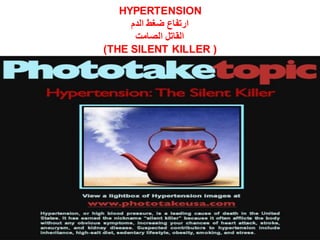 HYPERTENSION
‫الدم‬ ‫ضغط‬ ‫ارتفاع‬
‫الصامت‬ ‫القاتل‬
(THE SILENT KILLER )
 