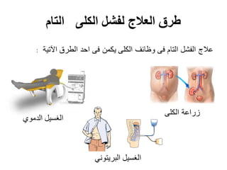 ‫الكلى‬ ‫لفشل‬ ‫العالج‬ ‫طرق‬‫التام‬
‫الدموي‬ ‫الغسيل‬
‫البريتوني‬ ‫الغسيل‬
‫الكلى‬ ‫زراعة‬
: ‫اآلتية‬ ‫الطرق‬ ‫احد‬ ‫فى‬ ‫يكمن‬ ‫الكلى‬ ‫وظائف‬ ‫فى‬ ‫التام‬ ‫الفشل‬ ‫عالج‬
 