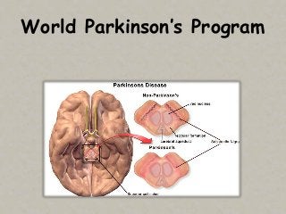 World Parkinson’s Program
 
