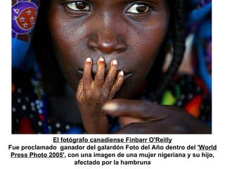 El fotógrafo canadiense Finbarr O'Reilly Fue proclamado  ganador del galardón Foto del Año dentro del  'World Press Photo 2005' , con una imagen de una mujer nigeriana y su hijo, afectado por la hambruna 