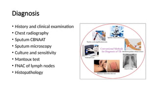 Diagnosis
• History and clinical examination
• Chest radiography
• Sputum CBNAAT
• Sputum microscopy
• Culture and sensitivity
• Mantoux test
• FNAC of lymph nodes
• Histopathology
 