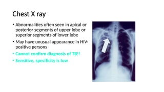 Chest X ray
• Abnormalities often seen in apical or
posterior segments of upper lobe or
superior segments of lower lobe
• May have unusual appearance in HIV-
positive persons
• Cannot confirm diagnosis of TB!!
• Sensitive, specificity is low
 