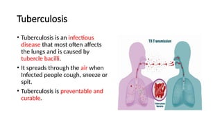 Tuberculosis
• Tuberculosis is an infectious
disease that most often affects
the lungs and is caused by
tubercle bacilli.
• It spreads through the air when
Infected people cough, sneeze or
spit.
• Tuberculosis is preventable and
curable.
 