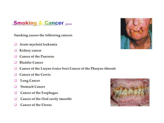 World tobacco day