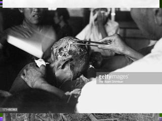 Lungsod ng Nagasaki matapos ang pagbomba
 